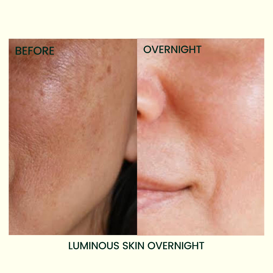 BAKUCHIOL RESURFACING NIGHT SERUM - with 10% Lactic Acid